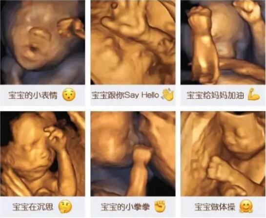 南阳圣玛孕妈咪课堂回顾：妊娠期不同孕周超声检查的临床意义
