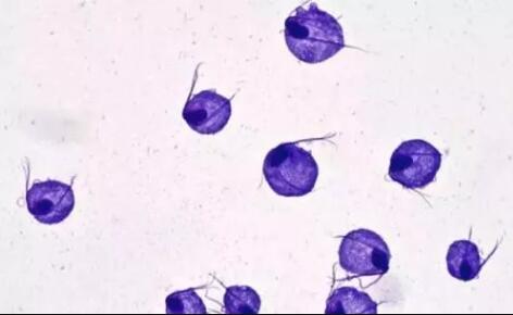 南阳宛成妇科医院：阴道滴虫，真的是虫吗？