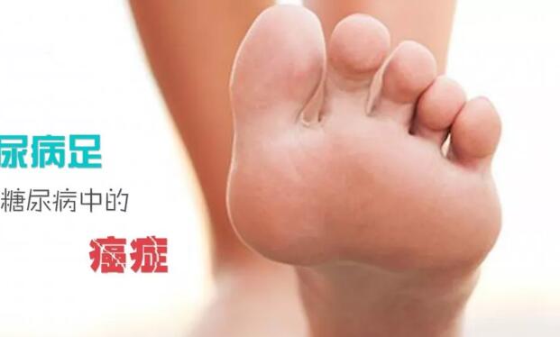 糖尿病的并发症：糖尿病足被称为糖尿病中的“癌症