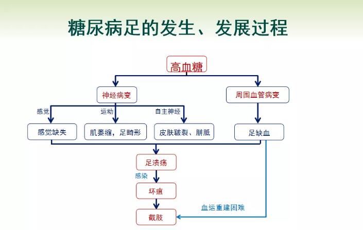 糖尿病的并发症：糖尿病足被称为糖尿病中的“癌症