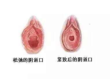 女人私密后花园要怎么保护？