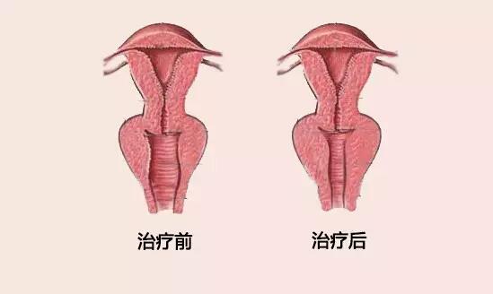 女人私密后花园要怎么保护？