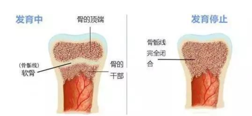你家孩子又长高了吗？