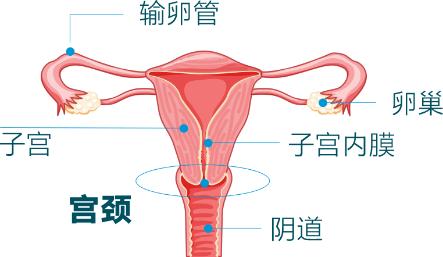 国际HPV知晓日| HPV早了解，宫颈癌早远离