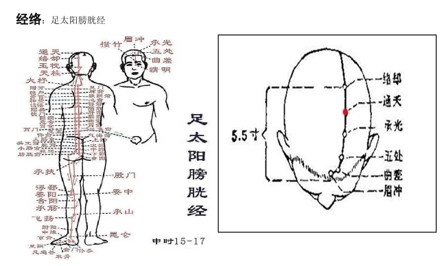通天穴：主治头痛，眩晕，鼻塞，鼻衄，鼻渊